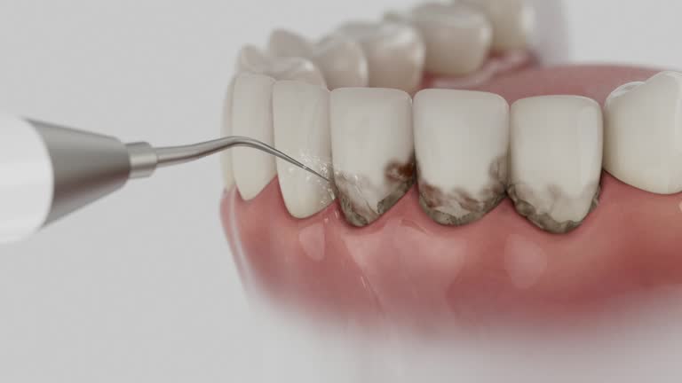 Reliable Dental contractor in Mamou, LA by Smile Center Dentistry